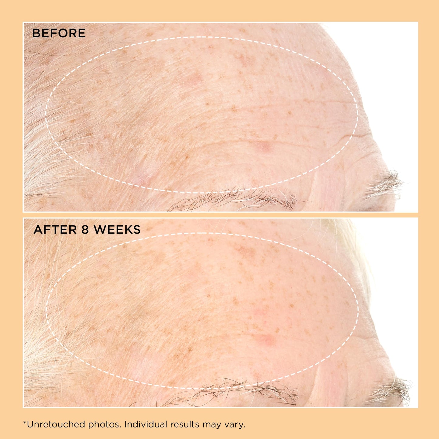 Perricone MD Neuropeptide Pro-Strength Firming Moisturizer, 2 fl oz.